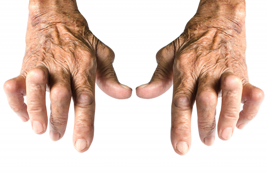 Seniors with arthritis