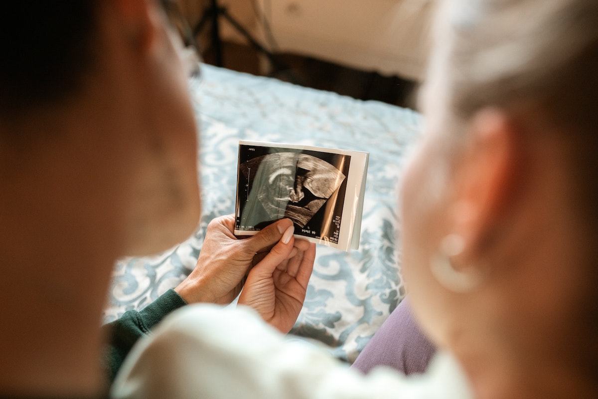 happy couple looking at their baby's first ultrasound photo